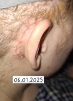 img-2