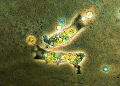 Bild von Amöben aus einem Schmutzwassertropfen in knapp tausendfacher Vergrößerung